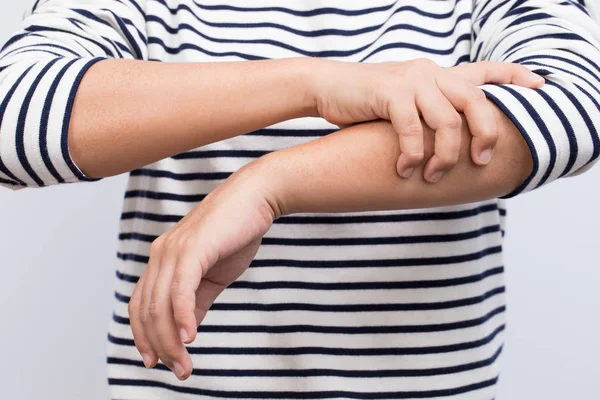 Mujer tiene dolor en el brazo — Foto de Stock