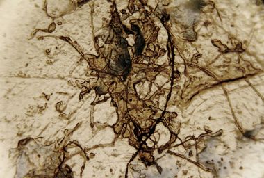 soyut mikroskobik doku