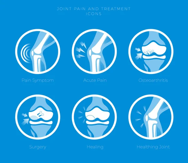 Set Icons Joints Treatment Cartilage Damage Arthritis Osteoarthritis Restoration Cartilage — Stock Vector