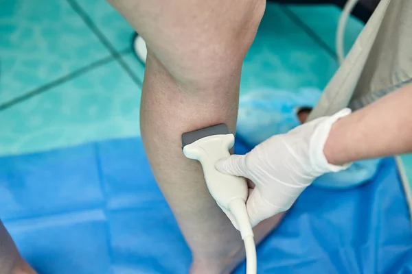 Doctor in white uniform with diagnostic equipment performs an ultrasound examination of leg veins of a female patient. Phlebologist working in modern clinic with Varicose Veins disease