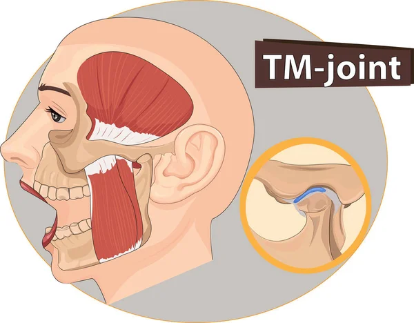 Vetor de Temporomandibular — Vetor de Stock