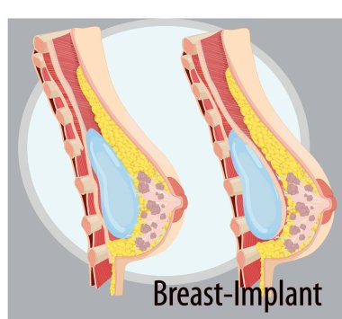 Vector Breast anatomy clipart