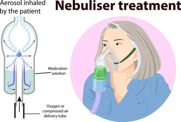 Ilustración Vectorial Anatomía Del Tratamiento Del Nebulizador — Vector de stock