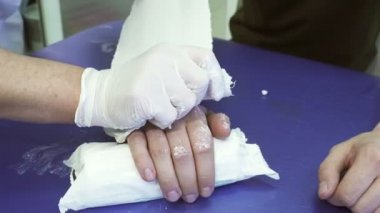 Doktor sıva bandaj hastalık hastanın koluna koyar..