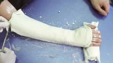 Doktor makas alçı lingette hastaların koluna keser..