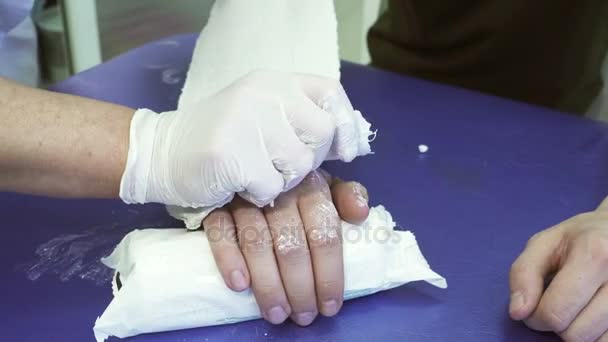 医者は病気の患者の腕に石膏包帯を置きます. — ストック動画
