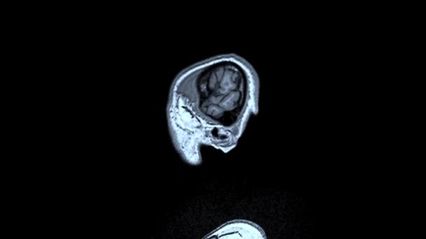 La tomografía médica computarizada MRI amplió el escaneo de la cabeza masculina joven sana — Vídeos de Stock