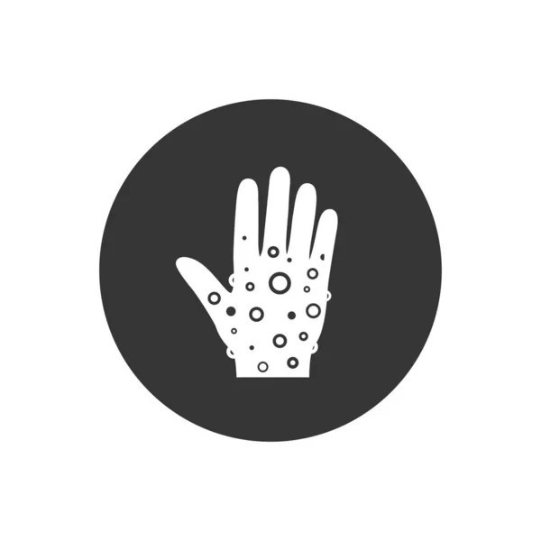 Ícone de pele da mão Eczema. sinal de estilo linear para conceito móvel e web design. Rash mão, reação alérgica contorno vetor ícone. Símbolo, ilustração do logotipo. Pixel vetor perfeito — Vetor de Stock