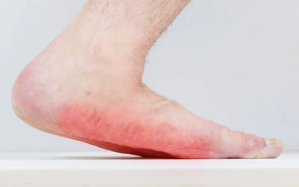 Erkek bacak ile güçlü düz taban türü.