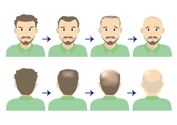 Balding head middle men — Stock Vector