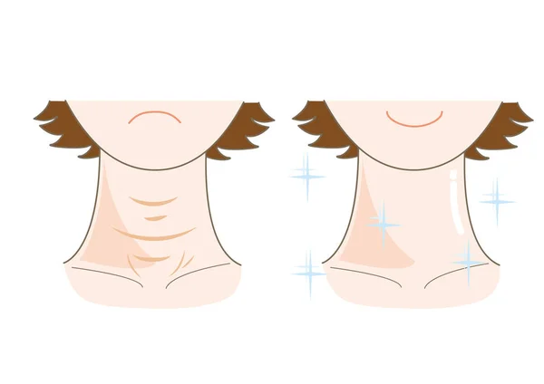 Rough skin of neck — Stock Vector
