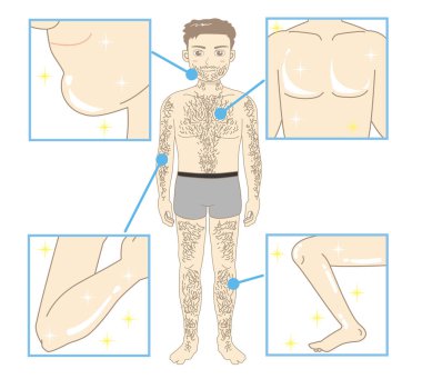 Erkek güzellik epilasyon