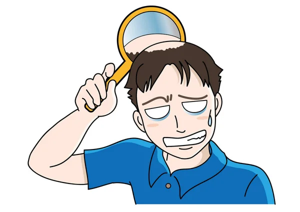 Проблемы выпадения волос для мужчин — стоковый вектор