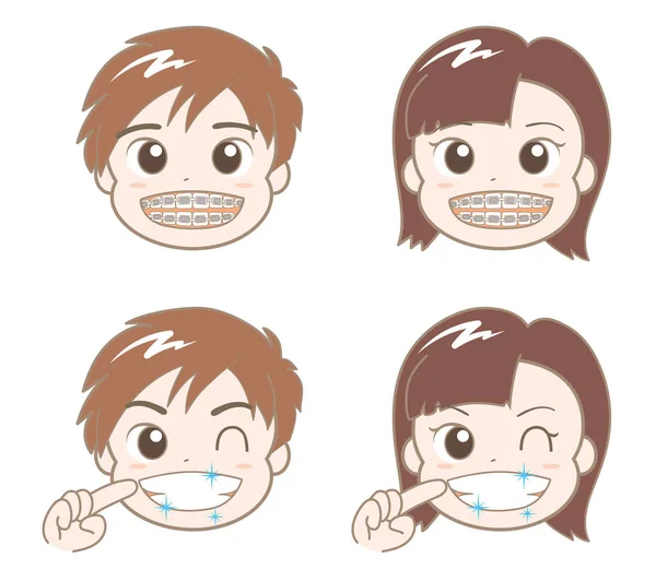 男の子と女の子の歯列矯正 — ストックベクタ