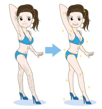 Kadın epilasyon görüntü - öncesi ve sonrası