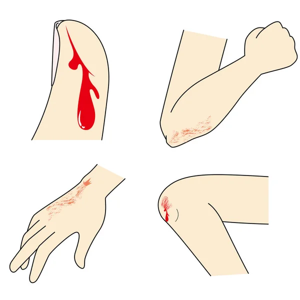 Blessures Aux Mains Aux Pieds — Image vectorielle