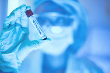 Bilim adamı doktor koronavirüse karşı bir aşı geliştirdi. Coronavirus 2019-nCoV kan örneği. Virüs salgını. Araştırma laboratuarında kan tüpü testi yapan bir teknisyen.