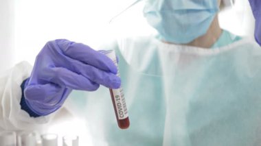 Laboratuvar asistanının ellerinde, teşhis koronavirüs enfeksiyonu için yapılan kan testlerinin laboratuvar örneği. Yakın plan..