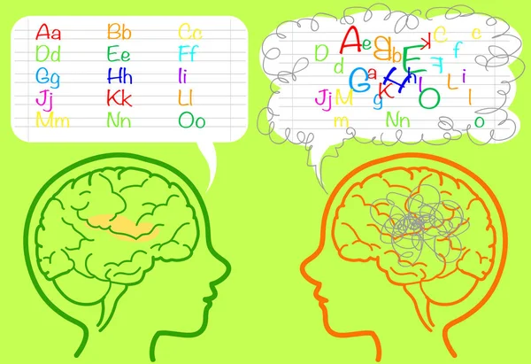 Dyslexie vecteur cérébral — Image vectorielle
