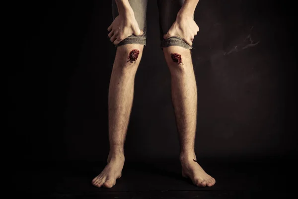 Подряпали коліна босоніж молодої людини — стокове фото
