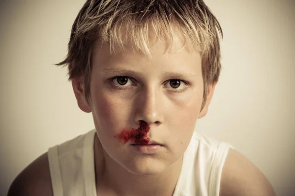 Teenage boy with a nosebleed — Stock Photo, Image