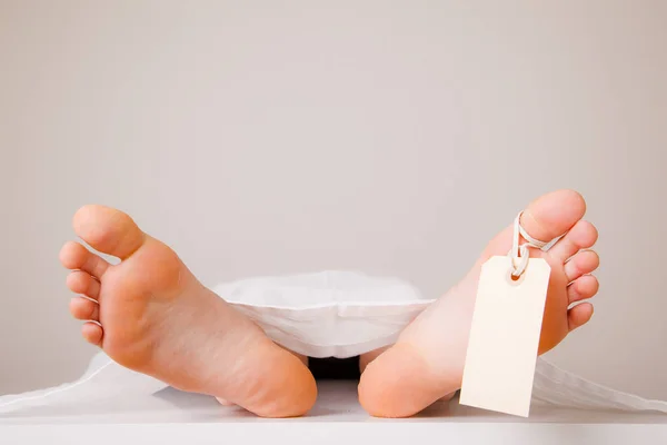 Kettő lábak-ból egy halott test — Stock Fotó