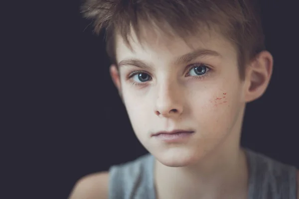 Cara séria com cicatrizes de menino jovem contra preto — Fotografia de Stock