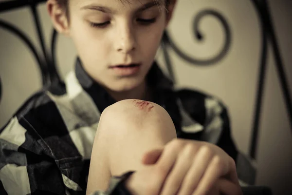 Jonge jongen kijken naar zijn knie met krassen — Stockfoto