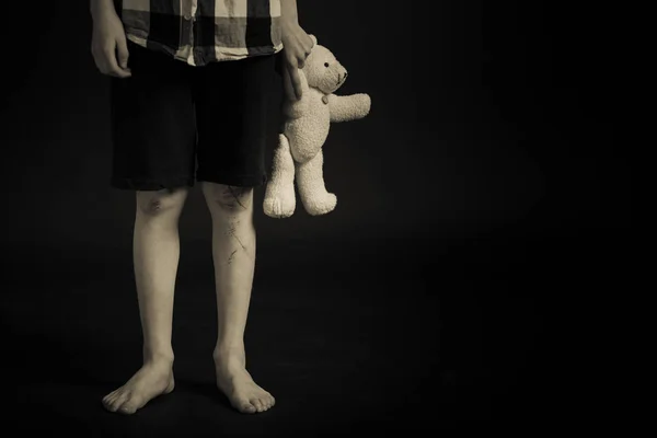 Young Boy with Legs Scars Holding his Teddy Bear — Stock Photo, Image