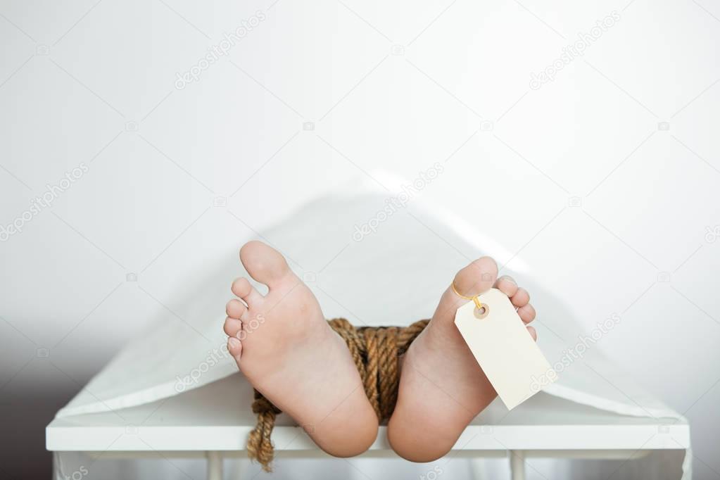 Boy on a mortuary table with bound legs