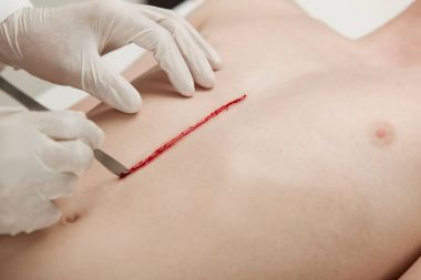 Doktor bir çocuğun göğsüne bir kesi yapmak