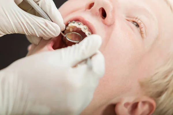 Joven adolescente en el dentista — Foto de Stock