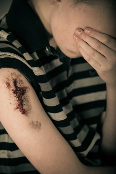 피 묻은 손으로 팔으로 불행 한 남자 아이 — 스톡 사진