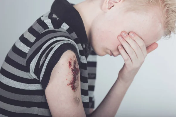 Niño varón llorón con brazo herido ensangrentado —  Fotos de Stock