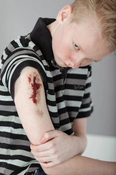 Αγόρι που κατέχουν αιματηρή χέρι με μεγάλο βαθειά πληγή — Φωτογραφία Αρχείου