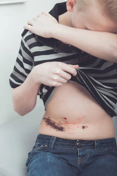 Κλάμα έφηβος θύμα εκθέτει γυμνή κοιλιά του — Φωτογραφία Αρχείου