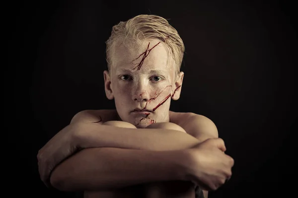 Jongen met bloed spattered over zijn gezicht — Stockfoto