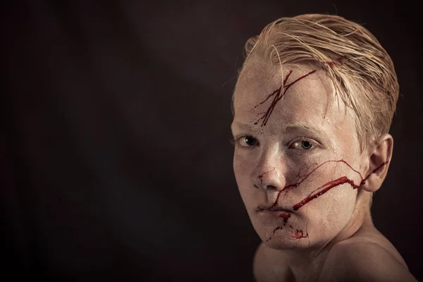 Jongen met bloed spattered over zijn gezicht staart — Stockfoto