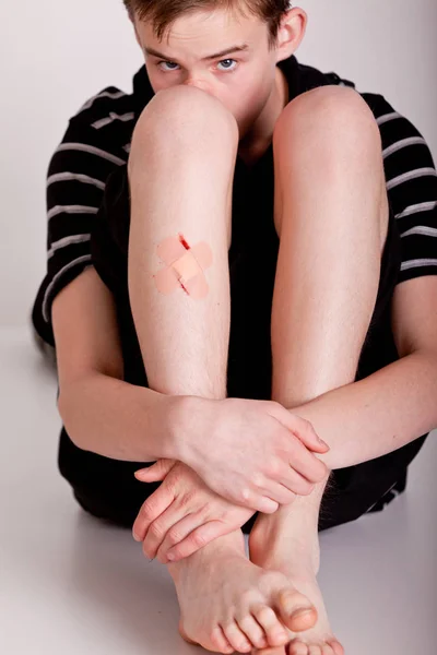 Embarrased boy in shorts with exposed injured shin Stock Photo