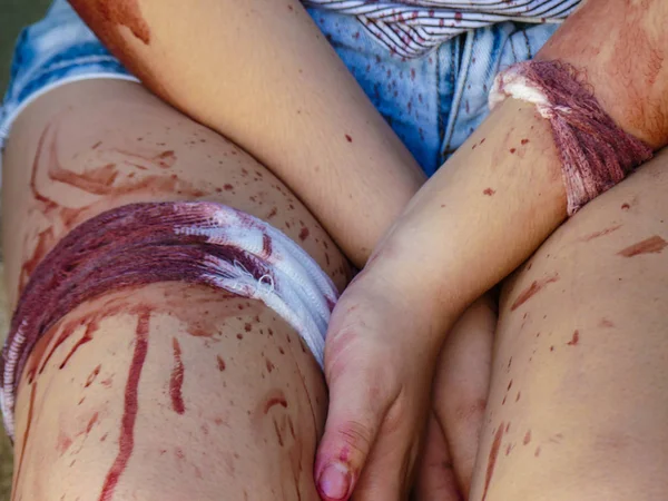 Tatlı kız yaralandı kaplı bacaklar kan kavramı yaralanma eller