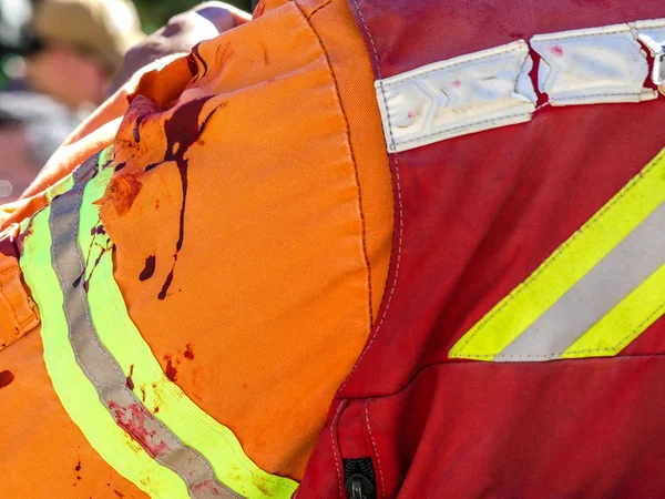 Injured fireman bloodstaines sleeve uniform — Stock Photo, Image