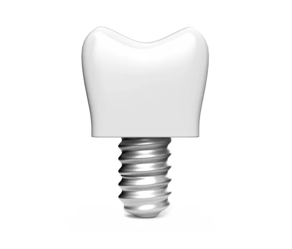Renderizar Dente Branco Implante Dentário Ícone Conjunto Close Isolado Fundo — Fotografia de Stock
