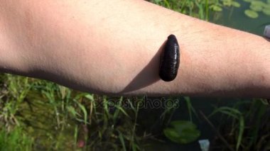 genç bir adam koluna yapışmış sülük