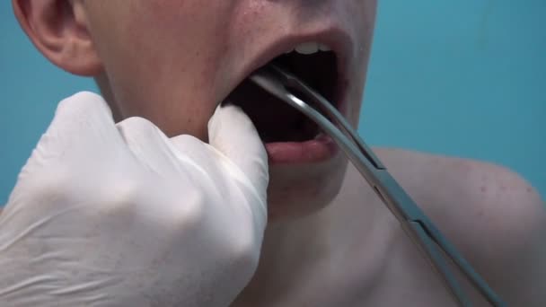 그 젊은 청년이 치과 치료를 받고 있었습니다. 치과 치료 — 비디오