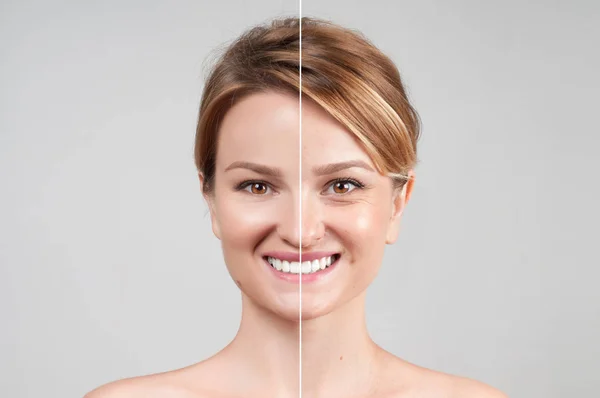 Женщина до и после косметической или пластической процедуры — стоковое фото