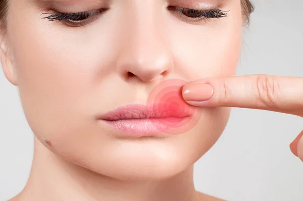 헤 르 페 스 바이러스에 의해 영향을 받는 여성 입술의 클로즈업 — 스톡 사진