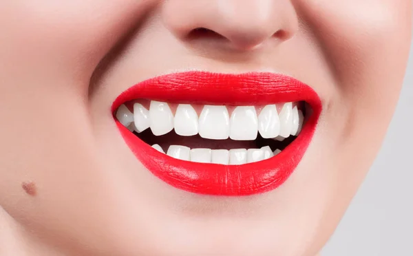 Dientes blancos y labios rojos. Sonrisa femenina perfecta después de blanquear los dientes . — Foto de Stock