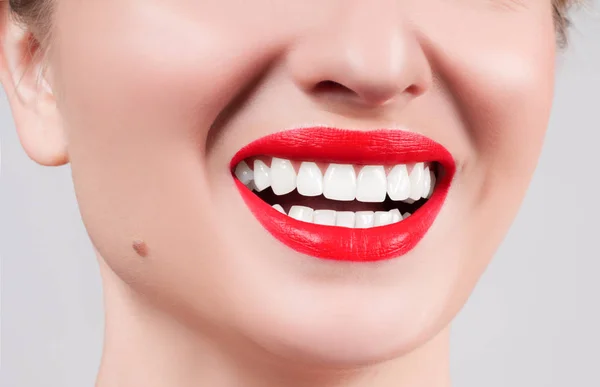 Dientes blancos y labios rojos. Sonrisa femenina perfecta después de blanquear los dientes . — Foto de Stock