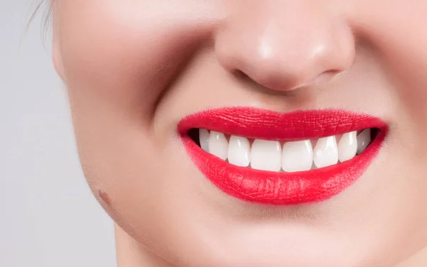 Bílé zuby a červené rty. Dokonalé ženy úsměv po bělení zubů. — Stock fotografie