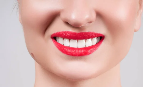 Dientes blancos y labios rojos. Sonrisa femenina perfecta después de blanquear los dientes . — Foto de Stock